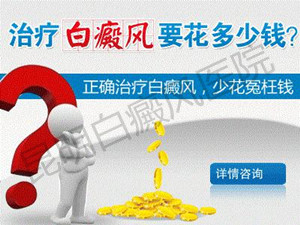 白癜风治疗要花多少钱?