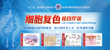 散发型白癜风到了晚期的症状是什么?