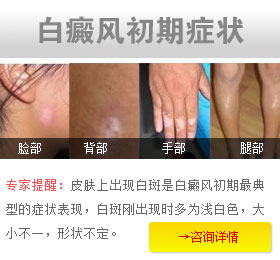 怎么确定自己的白斑是不是白癜风呢?