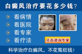 治疗白癜风大概需要花多少钱?