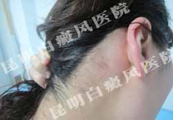 女大学生重拾昔日笑容