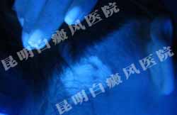 女大学生重拾昔日笑容