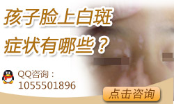 小孩脸上有白斑 家长不容忽视