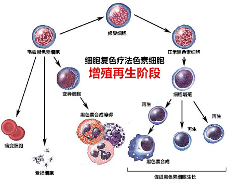 “细胞复色”疗法核心诠释