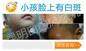 青少年白癜风怎么治疗?