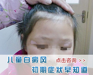 儿童白癜风的发病征兆有哪些?