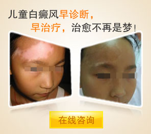 儿童白癜风的治疗与保健