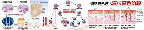 医学界公认为第四大白癜风治疗技术——“细胞复色”祛白技术