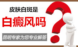 身上长白斑是白癜风吗?