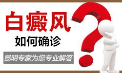 白癜风如何确诊